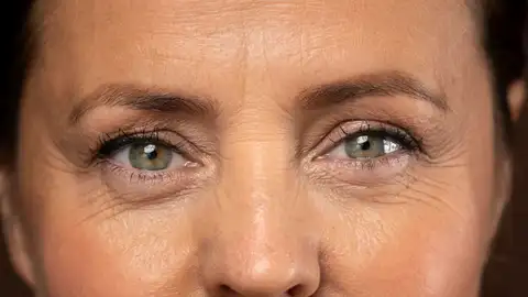 Mujer con arrugas Mujer con arrugas