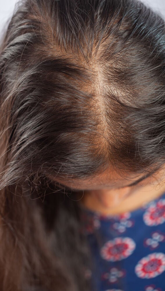 Cabello clarea