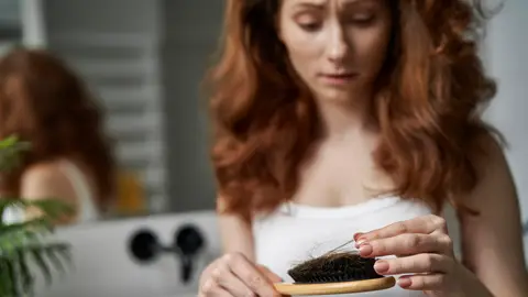 Caída de pelo Caída de pelo