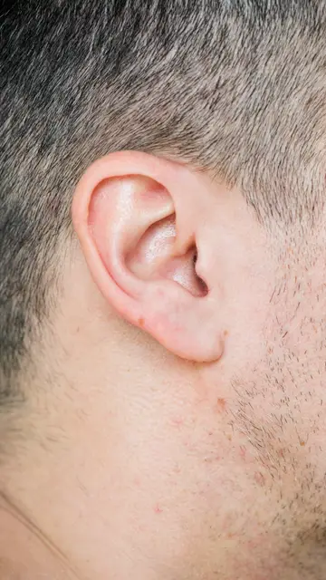 Oreja Oreja