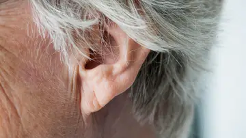 Lóbulo de la oreja Lóbulo de la oreja