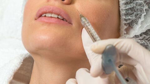 Inyección de un tratamiento estético