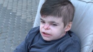 Leo, el menor que sufre piel de mariposa