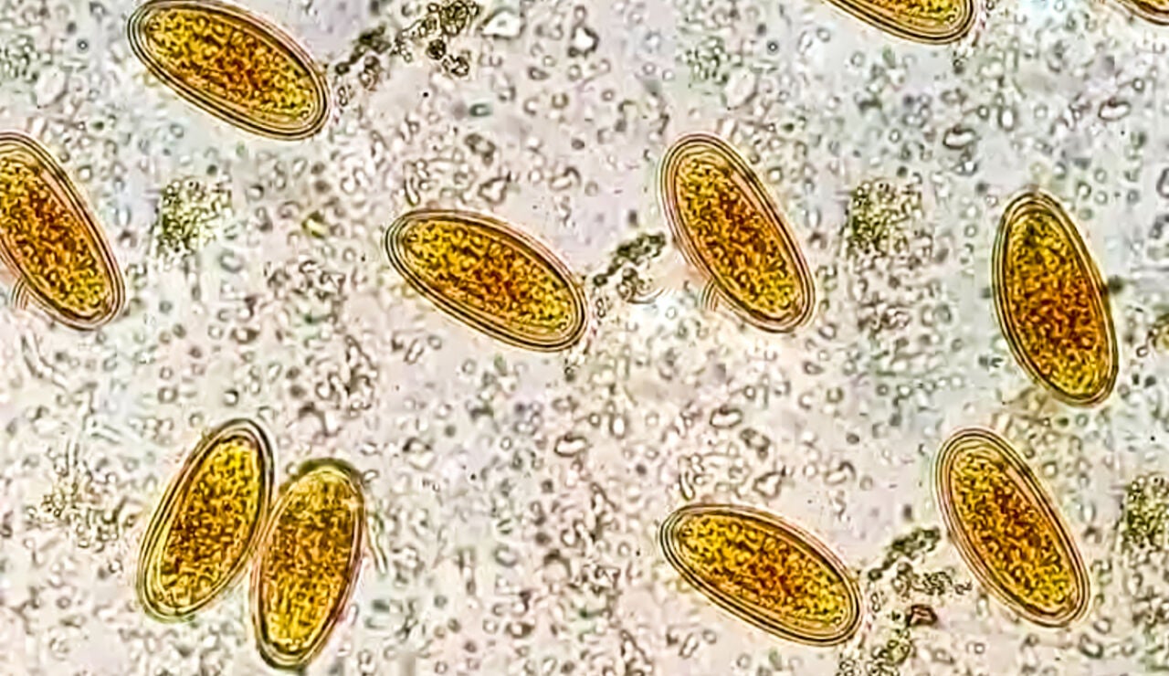 Enterobius vermicularis