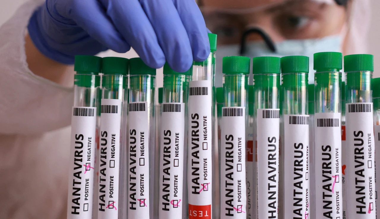 Hantavirus