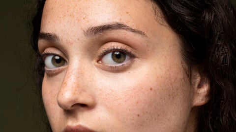 Mujer con pecas y lunares