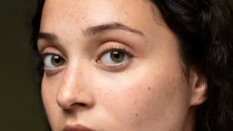 Mujer con pecas y lunares Mujer con pecas y lunares