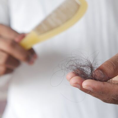 Ca&iacute;da del pelo