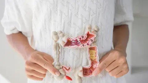 Manos sosteniendo el modelo del intestino Manos sosteniendo el modelo del intestino