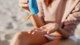 Mujer poni&eacute;ndose crema de sol