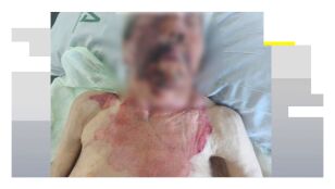 Las graves quemaduras sufridas por una anciana en una residencia de Granada