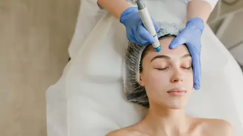 Mujer en una sesión de microneedling Mujer en una sesión de microneedling