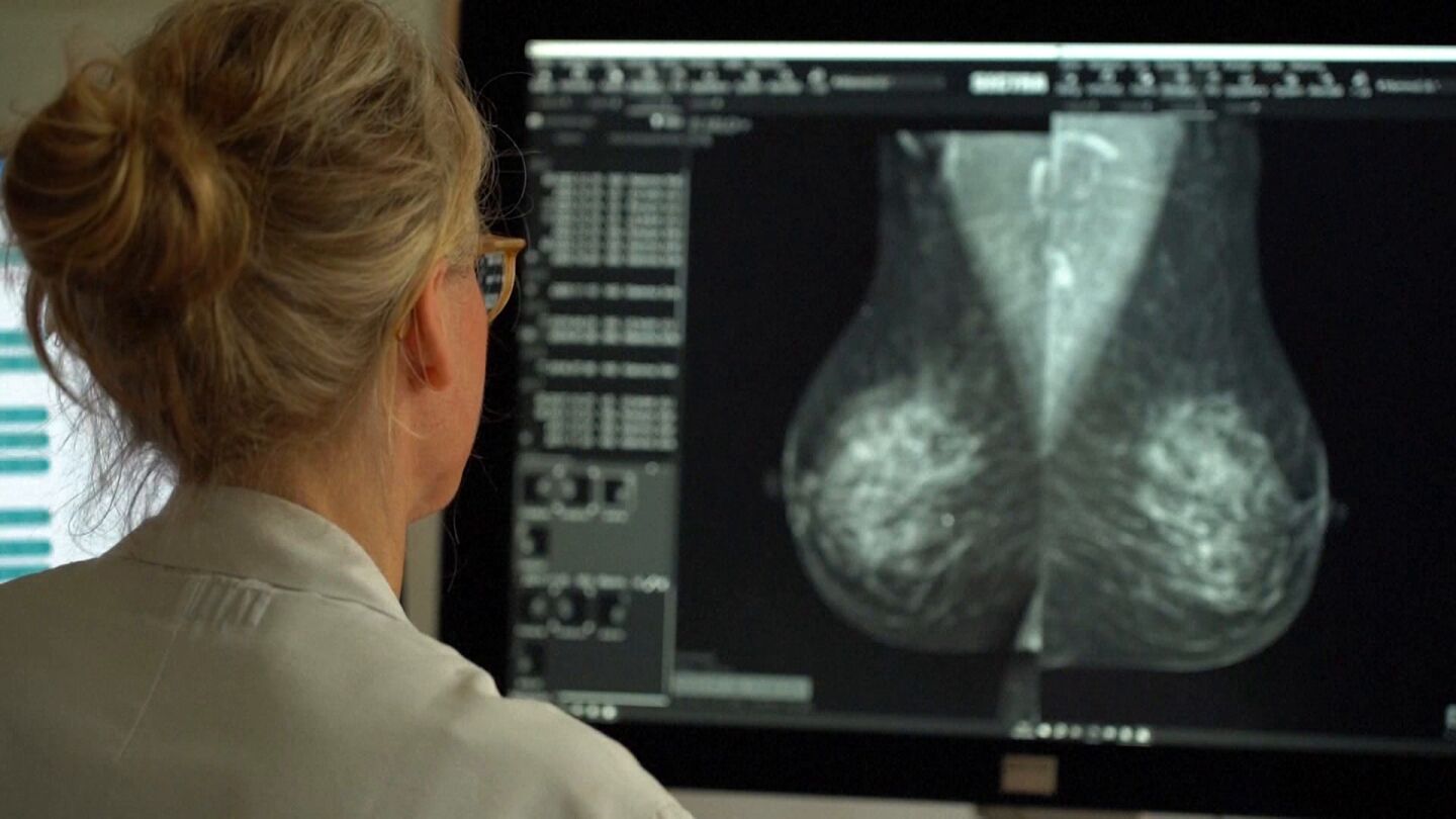 Investigaci&oacute;n sobre el c&aacute;ncer de mama