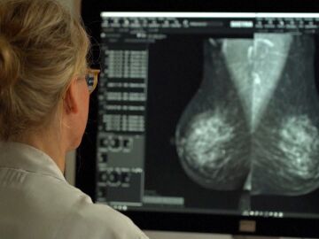 Investigaci&oacute;n sobre el c&aacute;ncer de mama