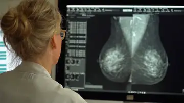 Investigación sobre el cáncer de mama Investigación sobre el cáncer de mama