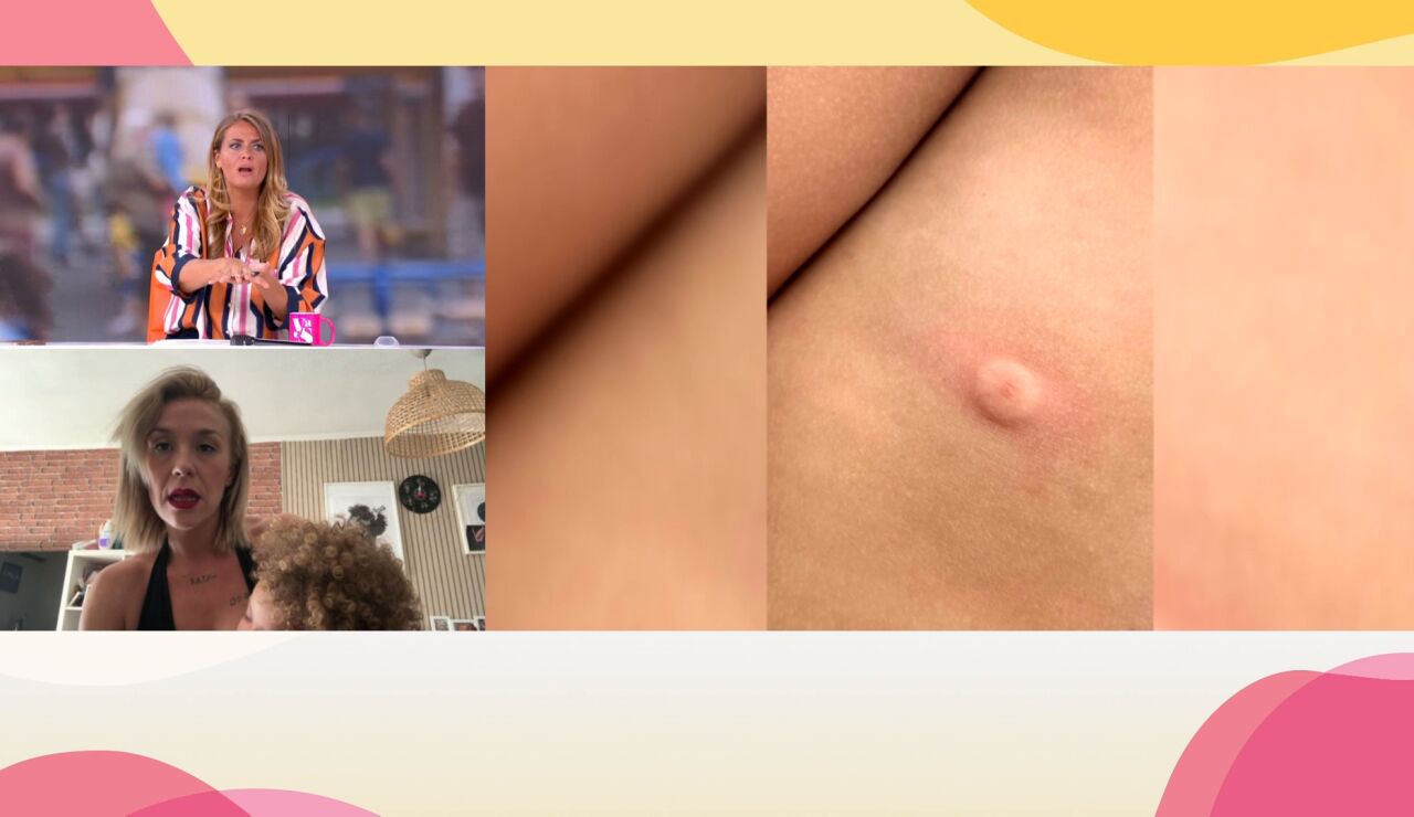 Picadura