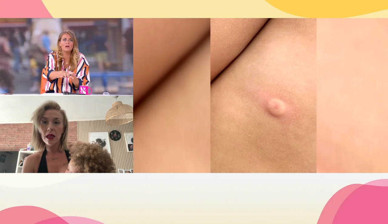 Picadura