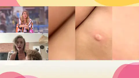 Picadura Picadura