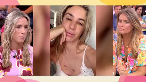 Cáncer de piel Cáncer de piel
