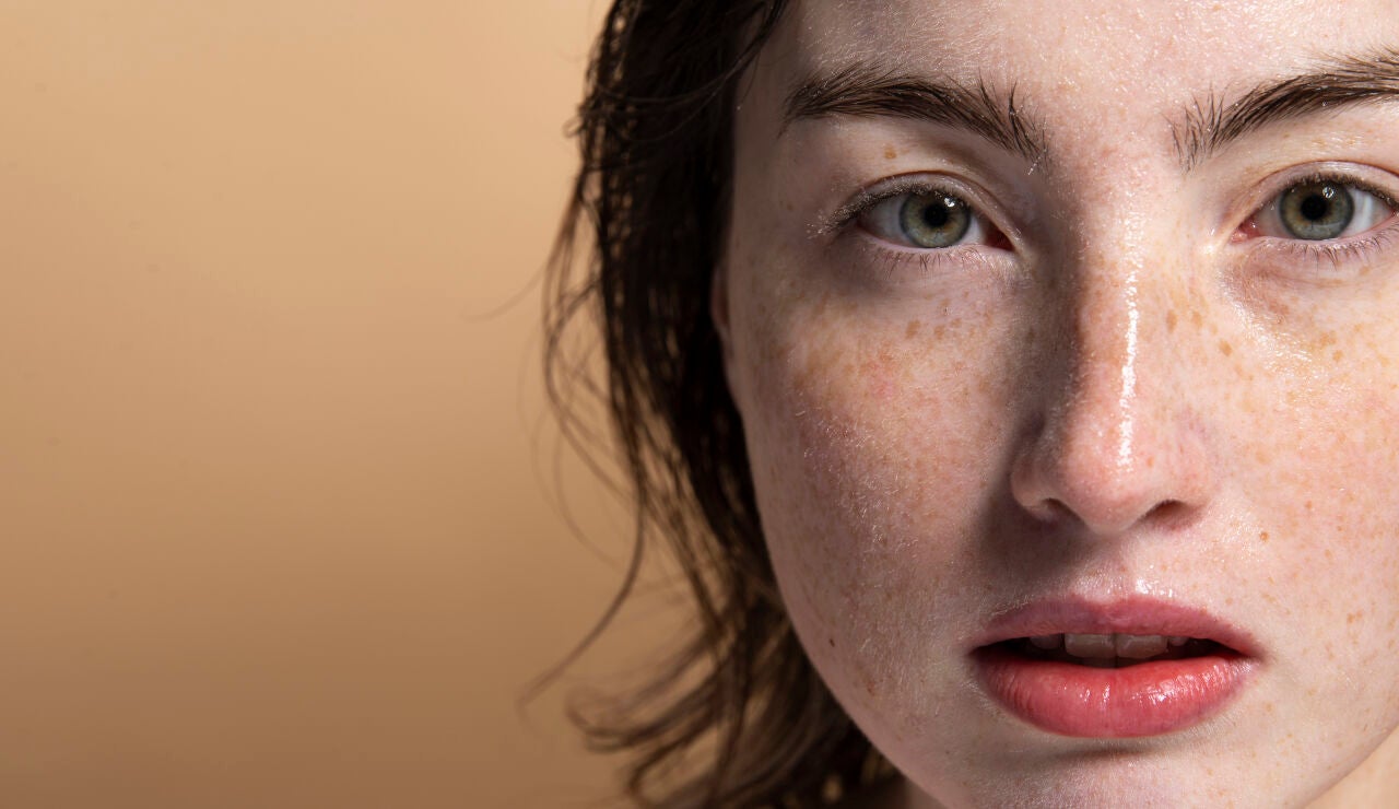Mujer con pecas