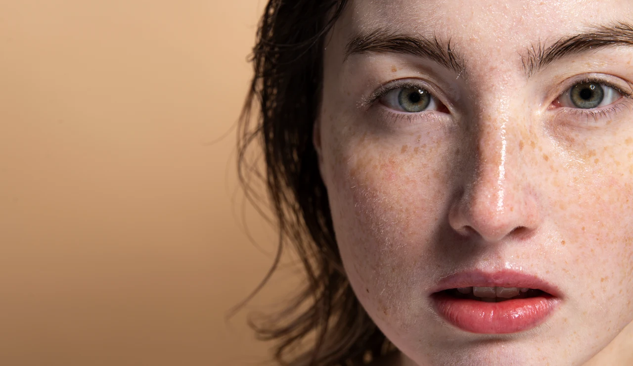 Mujer con pecas