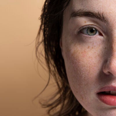 Mujer con pecas