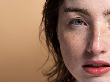 Mujer con pecas