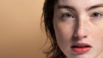 Mujer con pecas