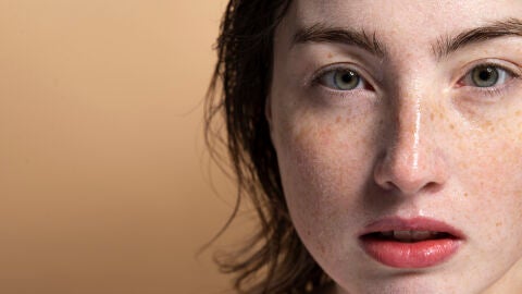 Mujer con pecas