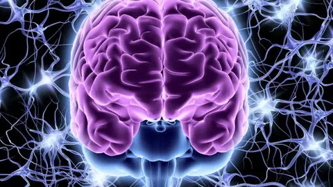 Cerebro Cerebro