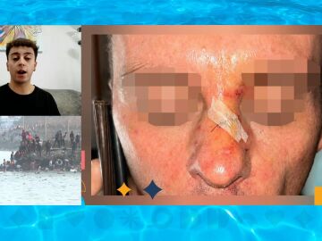 &Aacute;ngel, tras sufrir su familia una brutal agresi&oacute;n de radicales en Ceuta