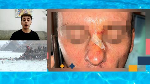 &Aacute;ngel, tras sufrir su familia una brutal agresi&oacute;n de radicales en Ceuta