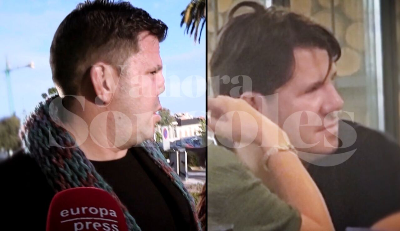 La imagen de la nueva nariz de Lucas
