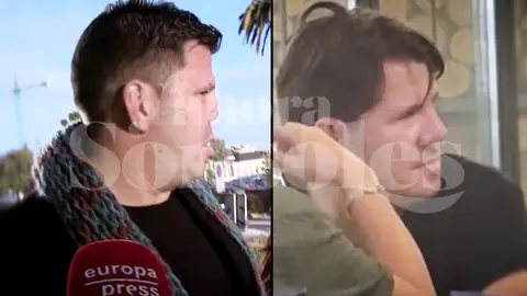La imagen de la nueva nariz de Lucas La imagen de la nueva nariz de Lucas