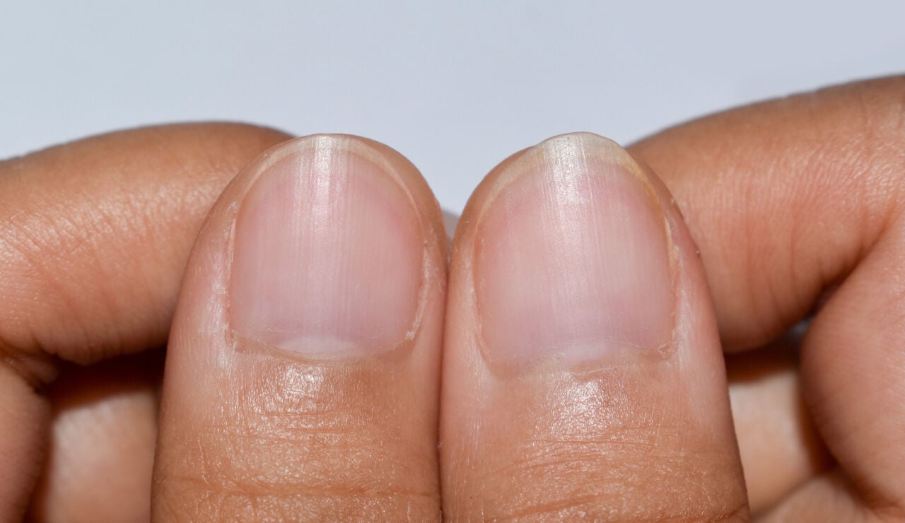 U&ntilde;as