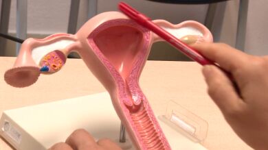 Un estudio andaluz identifica un biomarcador en sangre para distinguir tumores ováricos
