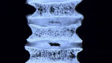 Estudio osteoporosis Estudio osteoporosis