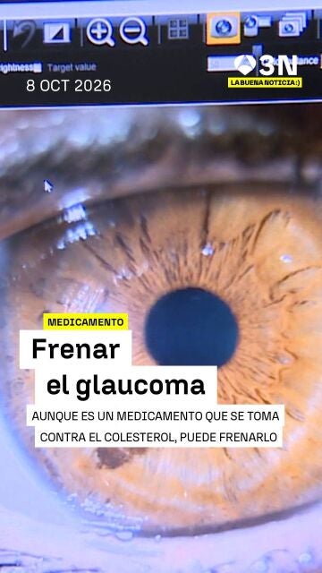 Poster de la card