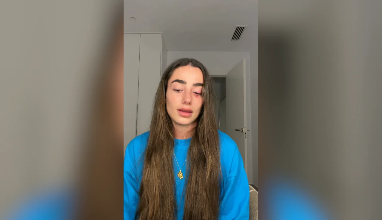 Lola Lolita anuncia que deja temporalmente las redes sociales