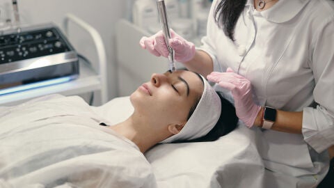 Tratamiento de microneedling