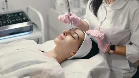 Tratamiento de microneedling Tratamiento de microneedling