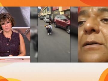 Siameses