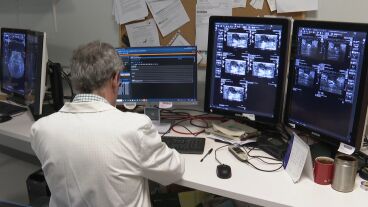Un m&eacute;dico revisando radiograf&iacute;as mamarias