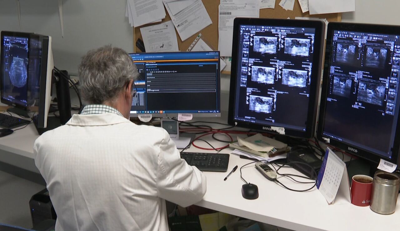 Un m&eacute;dico revisando radiograf&iacute;as mamarias