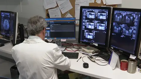 Un médico revisando radiografías mamarias Un médico revisando radiografías mamarias
