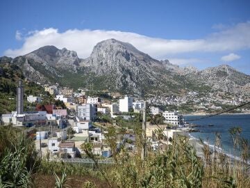 Sanidad declara el tercer caso de difteria en Ceuta en una semana