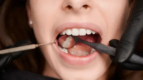 Mujer en el dentista Mujer en el dentista