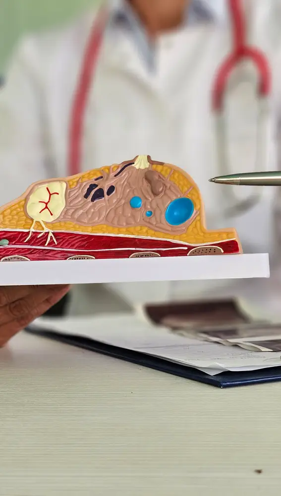 Pecho artificial para detectar anomalías del cáncer de mama Pecho artificial para detectar anomalías del cáncer de mama