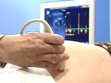 Reforma en la ley del aborto Reforma en la ley del aborto