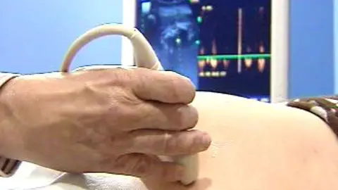 Reforma en la ley del aborto Reforma en la ley del aborto